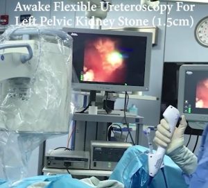 Awake Flexible