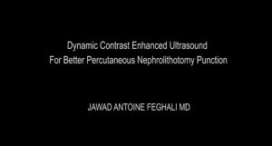 Dynamic Contrast Enhanced Ultrasound