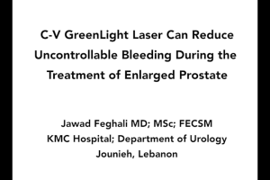 C-V Green Light Laser Technique